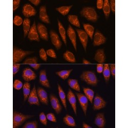 Golgin Subfamily A Member 4 (GOLGA4) Antibody