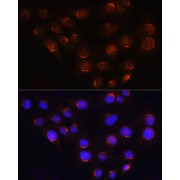 Immunofluorescence analysis of C6 cells using GOLGA4 Antibody (1/100 dilution, 40x lens). Blue: DAPI for nuclear staining.