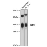 Western blot analysis of extracts of various cell lines using GZMK Antibody (1/1000 dilution).