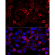 Immunofluorescence analysis of HeLa cells using HDAC6 Antibody (1/100 dilution, 40x lens). Blue: DAPI for nuclear staining.