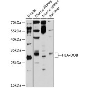 Western blot analysis of extracts of various cell lines using HLA-DOB Antibody (1/3000 dilution).