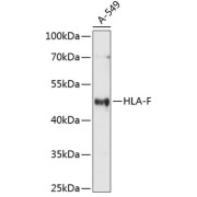Western blot analysis of extracts of A-549 cells using HLA-F Antibody (1/1000 dilution).