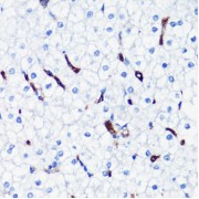 Immunohistochemistry of paraffin-embedded Human liver using HO-1 Antibody (1/200 dilution, 40x lens).