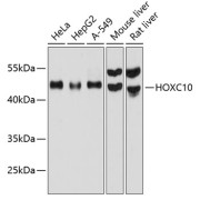 Western blot analysis of extracts of various cell lines using HOXC10 Antibody (1/1000 dilution).