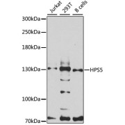 Western blot analysis of extracts of various cell lines using HPS5 Antibody (1/3000 dilution).