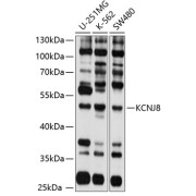 Western blot analysis of extracts of various cell lines using KCNJ8 Antibody (1/1000 dilution).