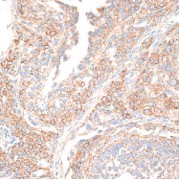 Immunohistochemistry of paraffin-embedded Rat ovary using KIF14 Antibody (1/100 dilution, 40x lens).