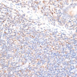 Kinesin Family, Member 14 (KIF14) Antibody