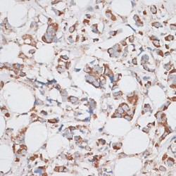 Kinesin Family, Member 14 (KIF14) Antibody
