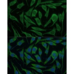 Kinesin Family, Member 14 (KIF14) Antibody