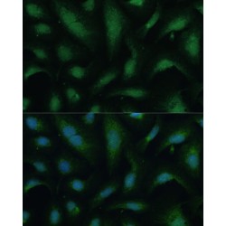 Kinesin Family, Member 14 (KIF14) Antibody