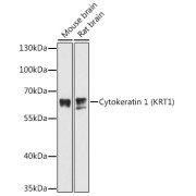 Western blot analysis of extracts of various cell lines using Cytokeratin 1 Antibody (1/3000 dilution).