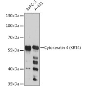 Western blot analysis of extracts of various cell lines using Cytokeratin 4 Antibody (1/3000 dilution).