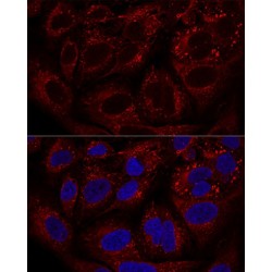 Ragulator Complex Protein LAMTOR1 (LAMTOR1) Antibody