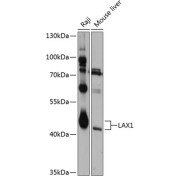 Western blot analysis of extracts of various cell lines using LAX1 Antibody (1/1000 dilution).
