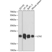 Western blot analysis of extracts of various cell lines using LCN2 Antibody (1/3000 dilution).