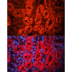 Neutrophil Gelatinase Associated Lipocalin / NGAL (LCN2) Antibody
