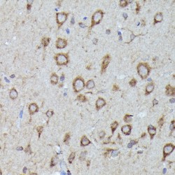 Leucine Rich Repeat Containing G Protein-Coupled Receptor 5 (LGR5) Antibody