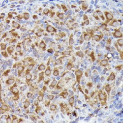 Leucine Rich Repeat Containing G Protein-Coupled Receptor 5 (LGR5) Antibody