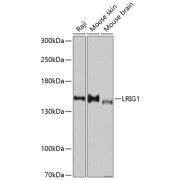 Western blot analysis of extracts of various cell lines using LRIG1 Antibody (1/3000 dilution).