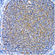 Immunohistochemistry of paraffin-embedded Rat ovary using MAP1LC3A Antibody (1/100 dilution, 40x lens).