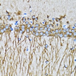 Microtubule-Associated Proteins 1A/1B Light Chain 3A (MAP1LC3A) Antibody