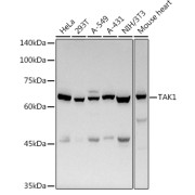 Western blot analysis of extracts of various cell lines using TAK1 Antibody (1/500 dilution).