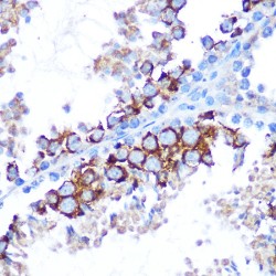 Mitogen-Activated Protein Kinase Kinase Kinase 7 (MAP3K7) Antibody
