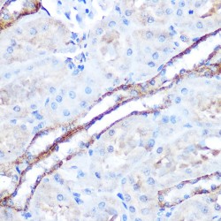 Mitogen-Activated Protein Kinase Kinase Kinase 7 (MAP3K7) Antibody