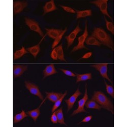 Mitogen-Activated Protein Kinase Kinase Kinase 7 (MAP3K7) Antibody