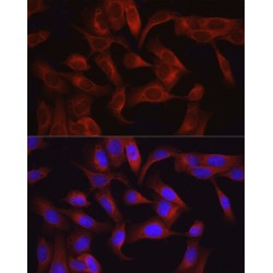 Mitogen-Activated Protein Kinase Kinase Kinase 7 (MAP3K7) Antibody