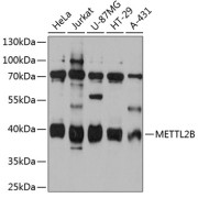 Western blot analysis of extracts of various cell lines using METTL2B Antibody (1/3000 dilution).