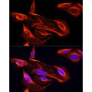 Immunofluorescence analysis of U2OS cells using MMP2 Antibody (1/100 dilution). Blue: DAPI for nuclear staining.