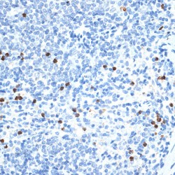 Matrix Metalloproteinase-9 (MMP9) Antibody