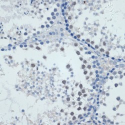 Matrix Metalloproteinase-9 (MMP9) Antibody