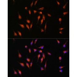 Matrix Metalloproteinase-9 (MMP9) Antibody