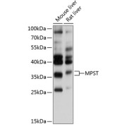 Western blot analysis of extracts of various cell lines using MPST Antibody (1/1000 dilution).