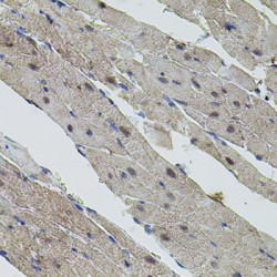 Myc Proto-Oncogene Protein (MYC) Antibody