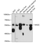 Western blot analysis of extracts of various cell lines using NAGS Antibody (1/3000 dilution).