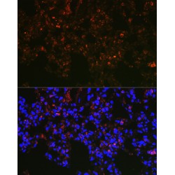 Napsin A (NAPSA) Antibody