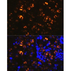 Napsin A (NAPSA) Antibody