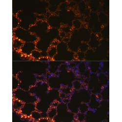 Napsin A (NAPSA) Antibody