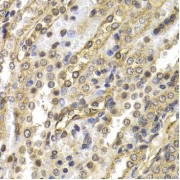 Immunohistochemistry of paraffin-embedded Rat kidney using NEDD9 Antibody (1/200 dilution, 40x lens).