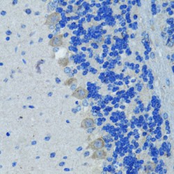 Nestin (NES) Antibody