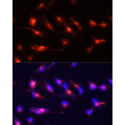 Nestin (NES) Antibody