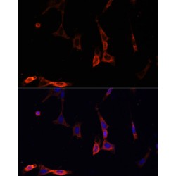 NF-Kappa-B Inhibitor Alpha (NFKBIA) Antibody