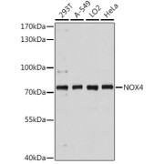 Western blot analysis of extracts of various cell lines using NOX4 Antibody (1/3000 dilution).