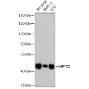 Western blot analysis of extracts of various cell lines using NPTX2 Antibody (1/3000 dilution).