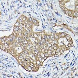 Obg-Like ATPase 1 (OLA1) Antibody