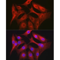 Obg-Like ATPase 1 (OLA1) Antibody